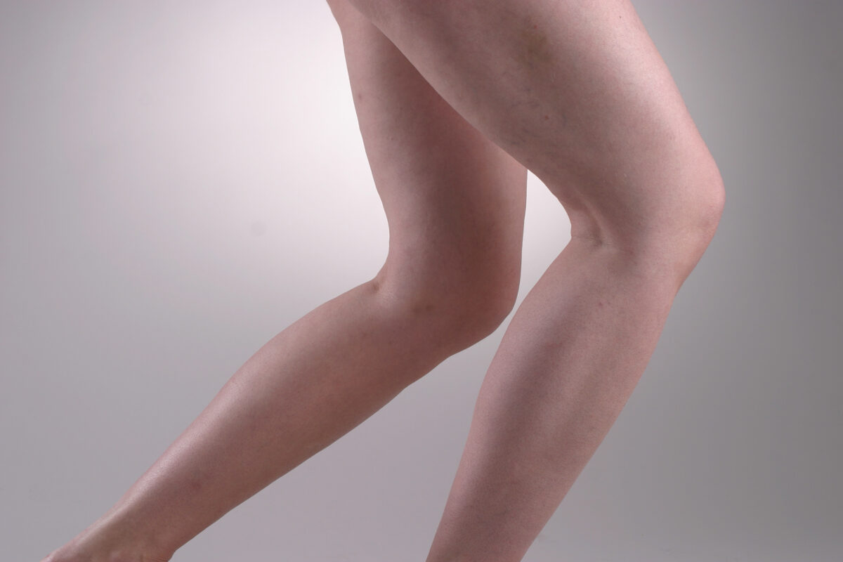 Knie